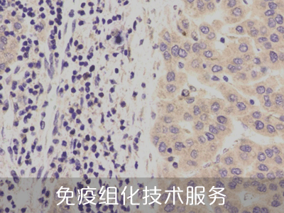 免疫组化技术服务