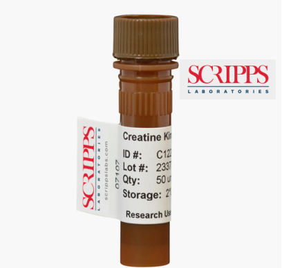 Folate Binding Protein