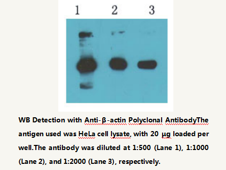 Anti-&beta;-actin Rabbit Polyclonal Antibody