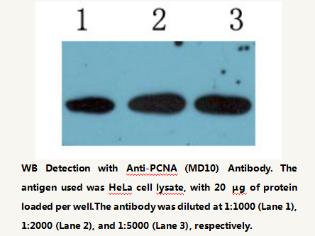 Anti-PCNA Mouse Monoclonal Antibody