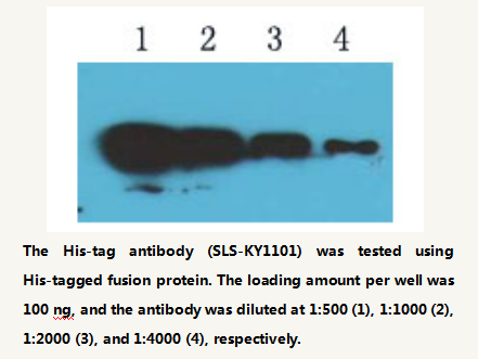 Anti-His-tag Rabbit Polyclonal Antibody