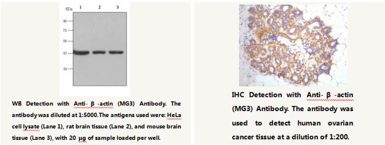 Anti-&beta;-actin Mouse Monoclonal Antibody